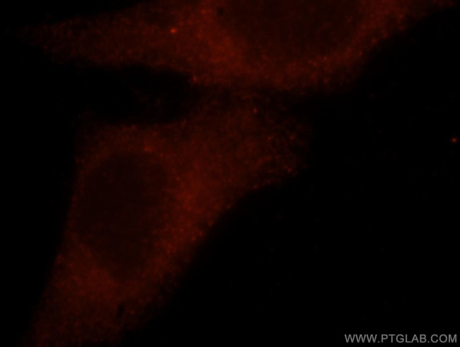 TARA Antibody in Immunocytochemistry (ICC/IF)