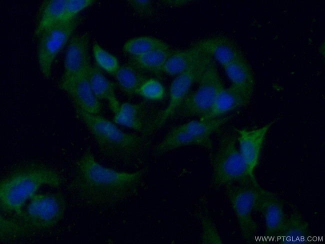 PGAM1 Antibody in Immunocytochemistry (ICC/IF)