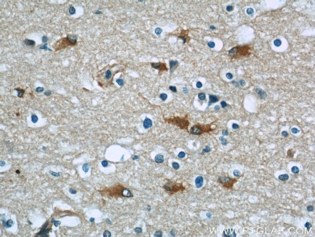 PGAM1 Antibody in Immunohistochemistry (Paraffin) (IHC (P))