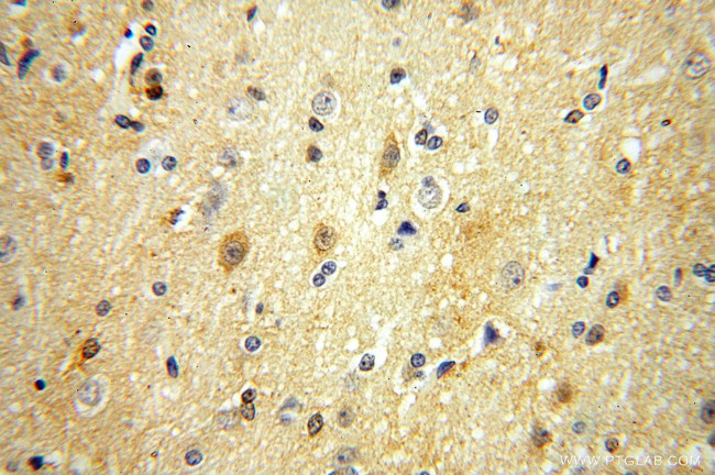 PGAM1 Antibody in Immunohistochemistry (Paraffin) (IHC (P))