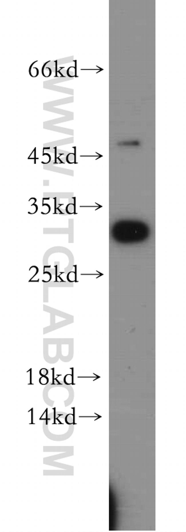 PGAM1 Antibody in Western Blot (WB)