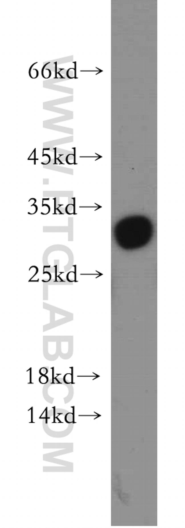 PGAM1 Antibody in Western Blot (WB)