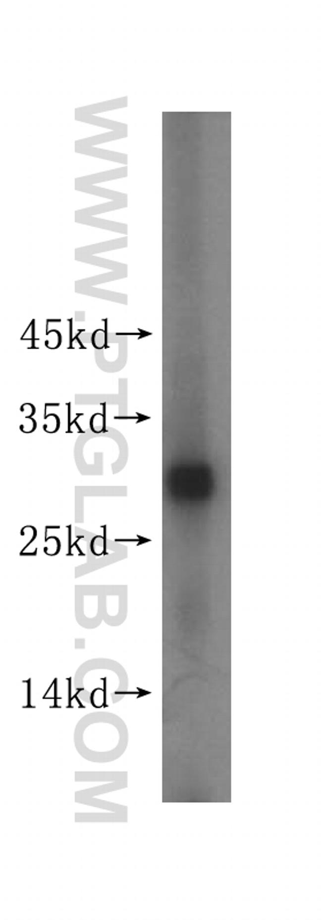 PGAM1 Antibody in Western Blot (WB)