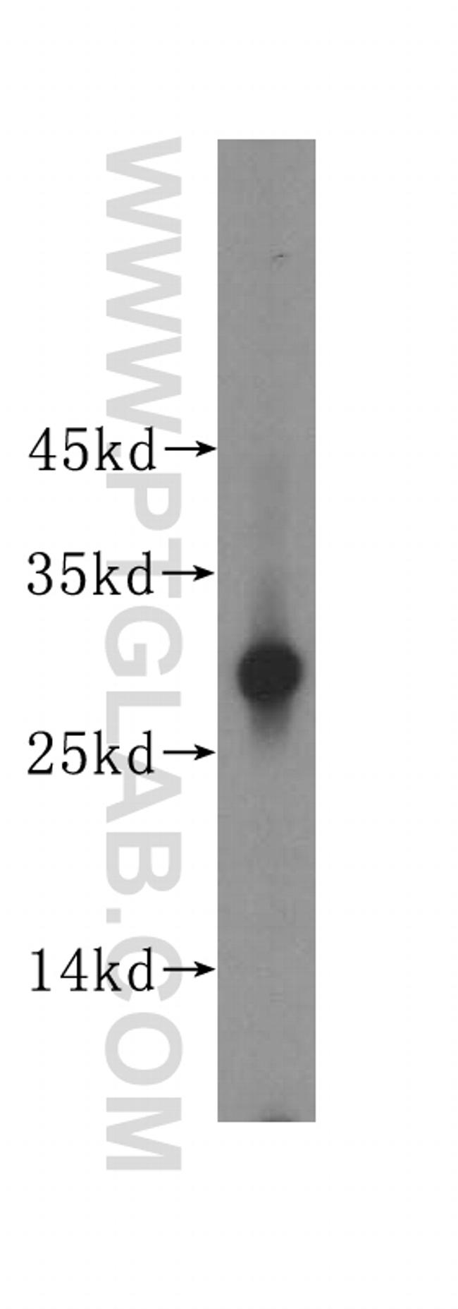 PGAM1 Antibody in Western Blot (WB)