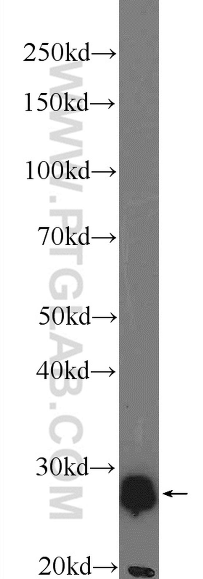 PGAM1 Antibody in Western Blot (WB)