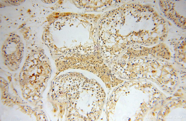 NXN Antibody in Immunohistochemistry (Paraffin) (IHC (P))