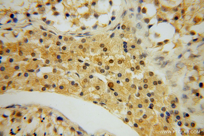 NXN Antibody in Immunohistochemistry (Paraffin) (IHC (P))