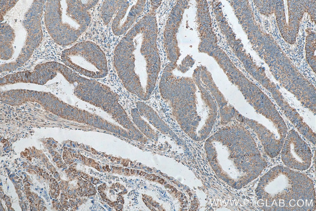 NXN Antibody in Immunohistochemistry (Paraffin) (IHC (P))