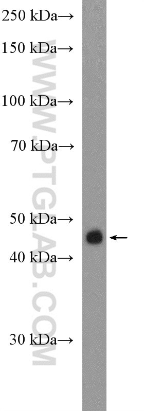 Citrate synthase Antibody in Western Blot (WB)