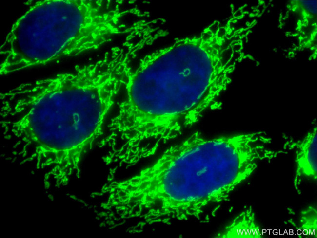 Citrate synthase Antibody in Immunocytochemistry (ICC/IF)