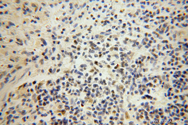 RNASEH2A Antibody in Immunohistochemistry (Paraffin) (IHC (P))