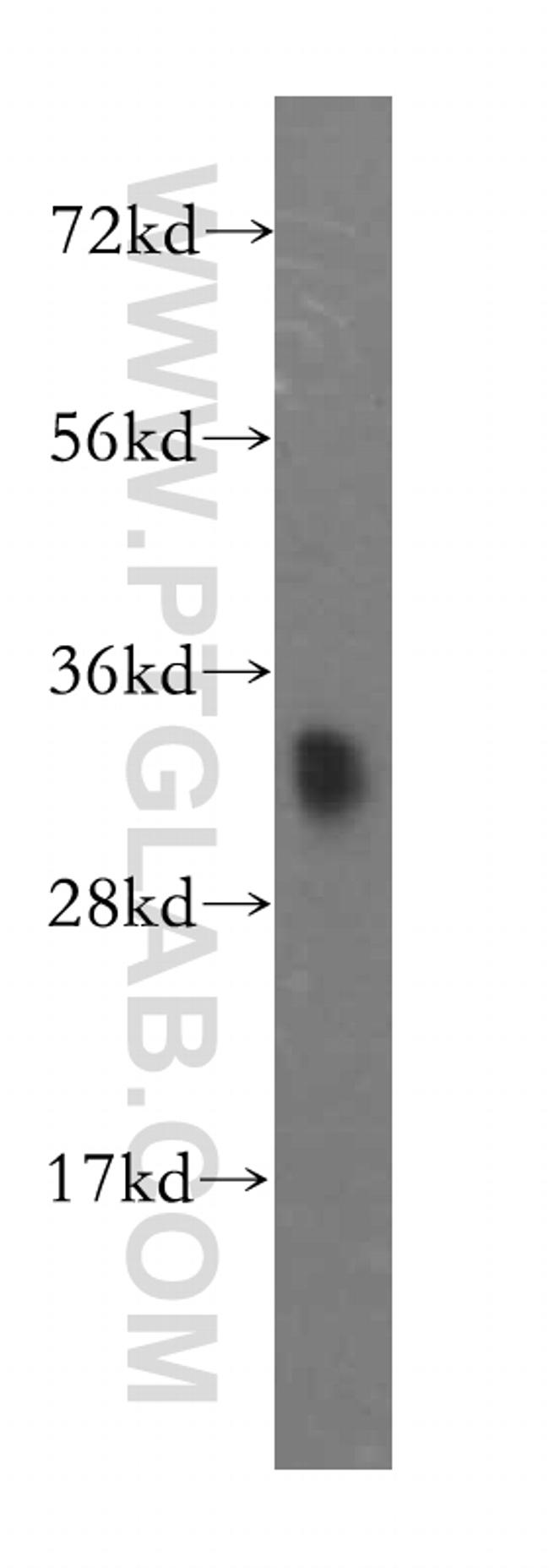 RNASEH2A Antibody in Western Blot (WB)