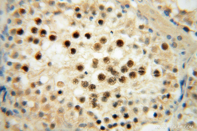 RNASEH2A Antibody in Immunohistochemistry (Paraffin) (IHC (P))