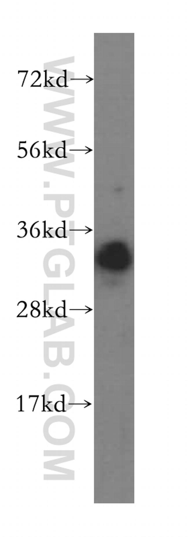 RNASEH2A Antibody in Western Blot (WB)