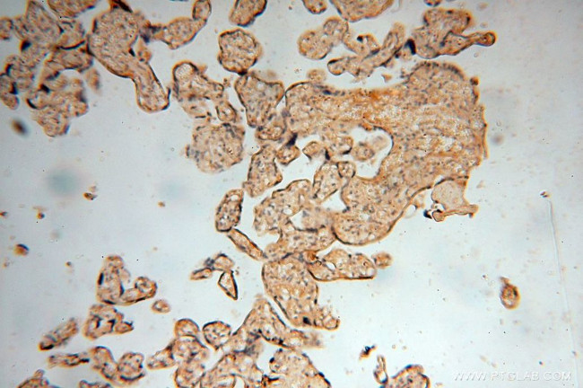 MUL1 Antibody in Immunohistochemistry (Paraffin) (IHC (P))