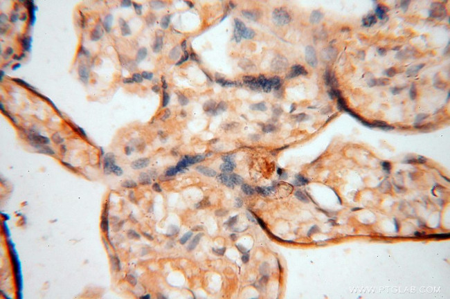 MUL1 Antibody in Immunohistochemistry (Paraffin) (IHC (P))