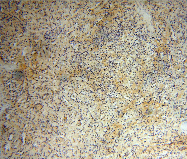 MUL1 Antibody in Immunohistochemistry (Paraffin) (IHC (P))