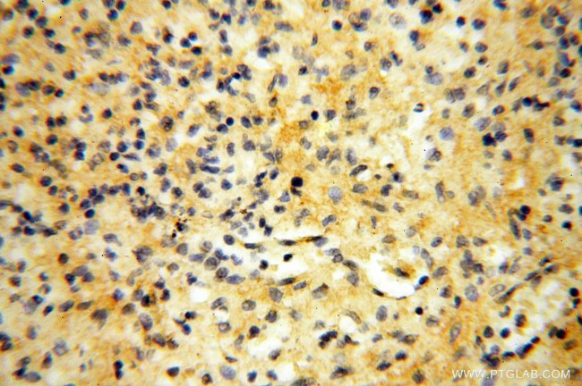 MUL1 Antibody in Immunohistochemistry (Paraffin) (IHC (P))