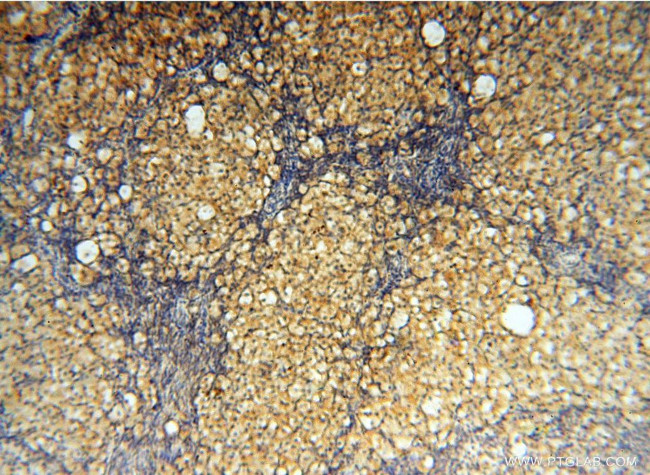 MUL1 Antibody in Immunohistochemistry (Paraffin) (IHC (P))