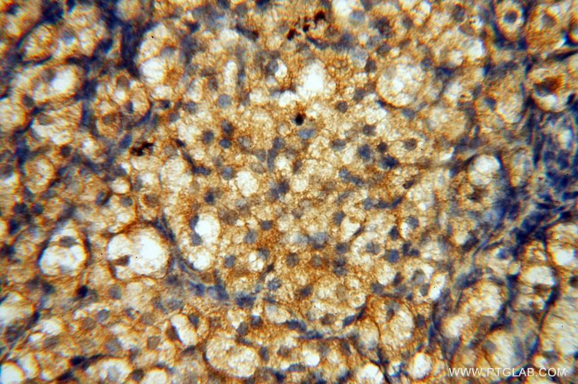 MUL1 Antibody in Immunohistochemistry (Paraffin) (IHC (P))