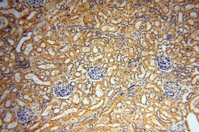 MUL1 Antibody in Immunohistochemistry (Paraffin) (IHC (P))