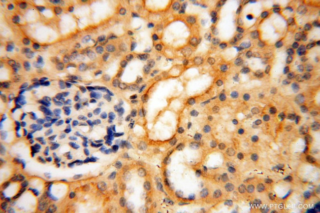 MUL1 Antibody in Immunohistochemistry (Paraffin) (IHC (P))