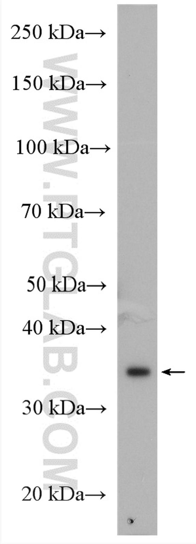 MUL1 Antibody in Western Blot (WB)