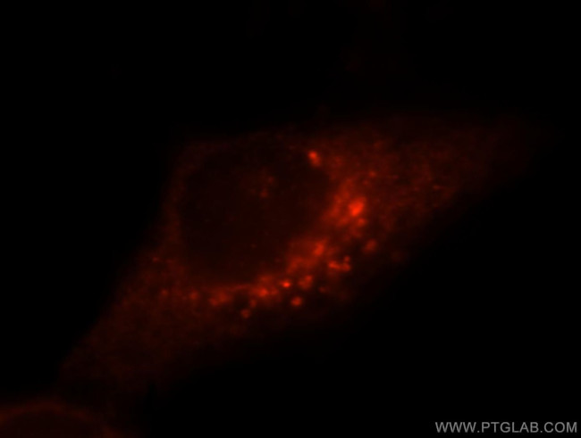 ITPA Antibody in Immunocytochemistry (ICC/IF)