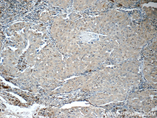 ITPA Antibody in Immunohistochemistry (Paraffin) (IHC (P))