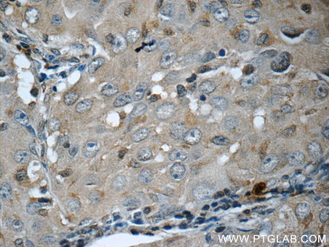 ITPA Antibody in Immunohistochemistry (Paraffin) (IHC (P))