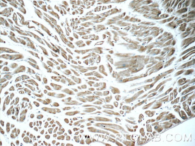 ITPA Antibody in Immunohistochemistry (Paraffin) (IHC (P))