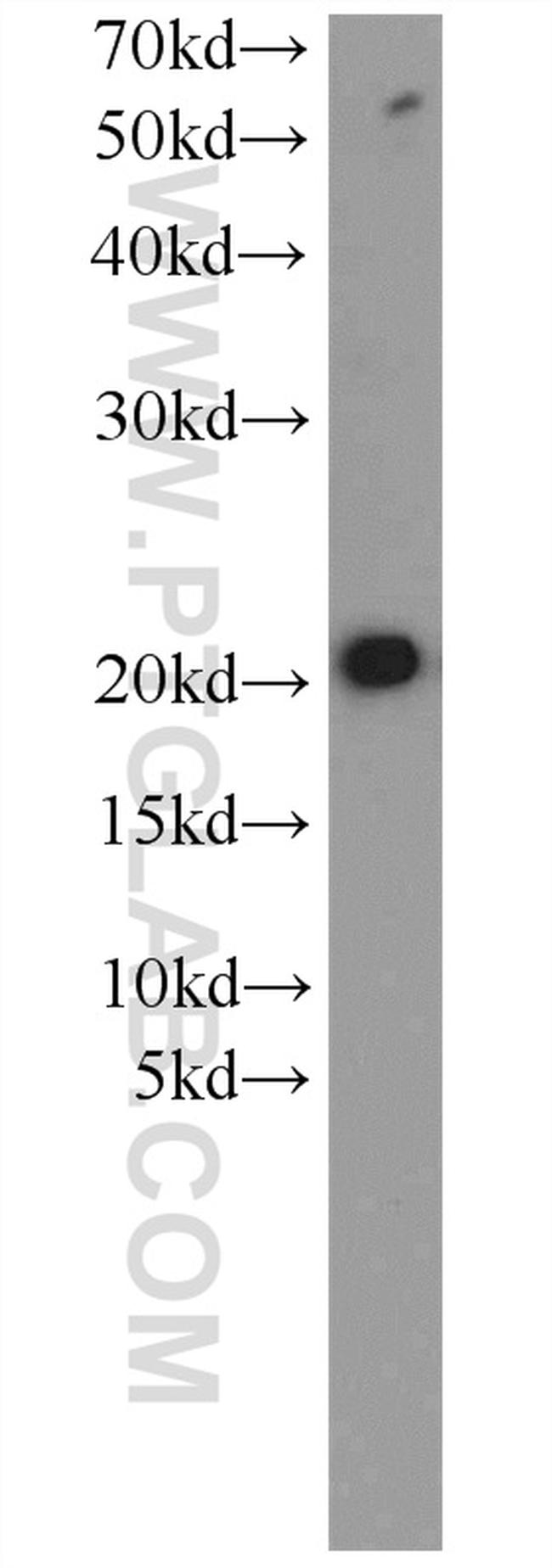 ITPA Antibody in Western Blot (WB)