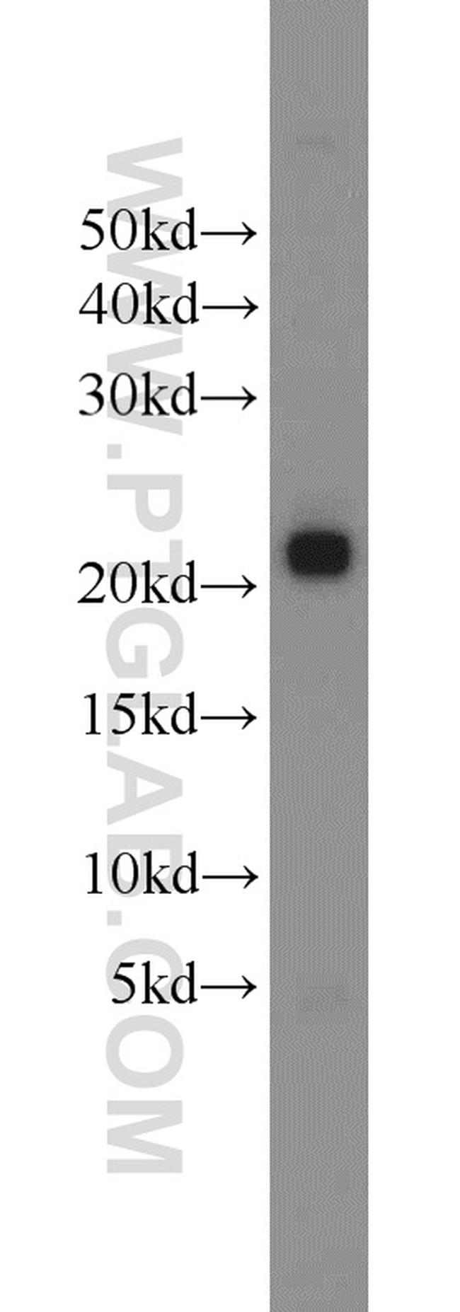 ITPA Antibody in Western Blot (WB)