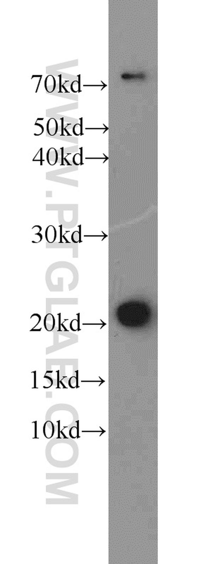 ITPA Antibody in Western Blot (WB)