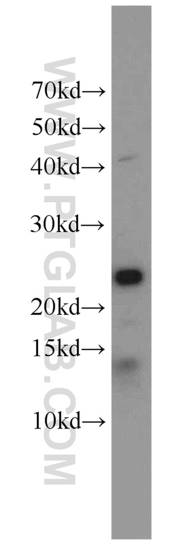 ITPA Antibody in Western Blot (WB)