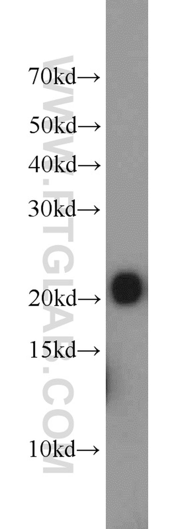 ITPA Antibody in Western Blot (WB)