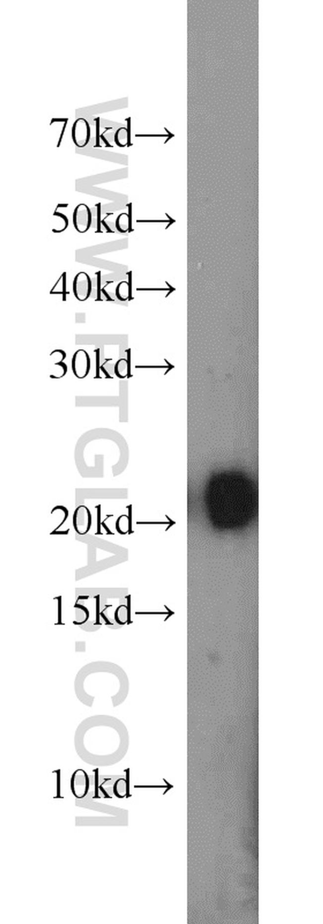 ITPA Antibody in Western Blot (WB)