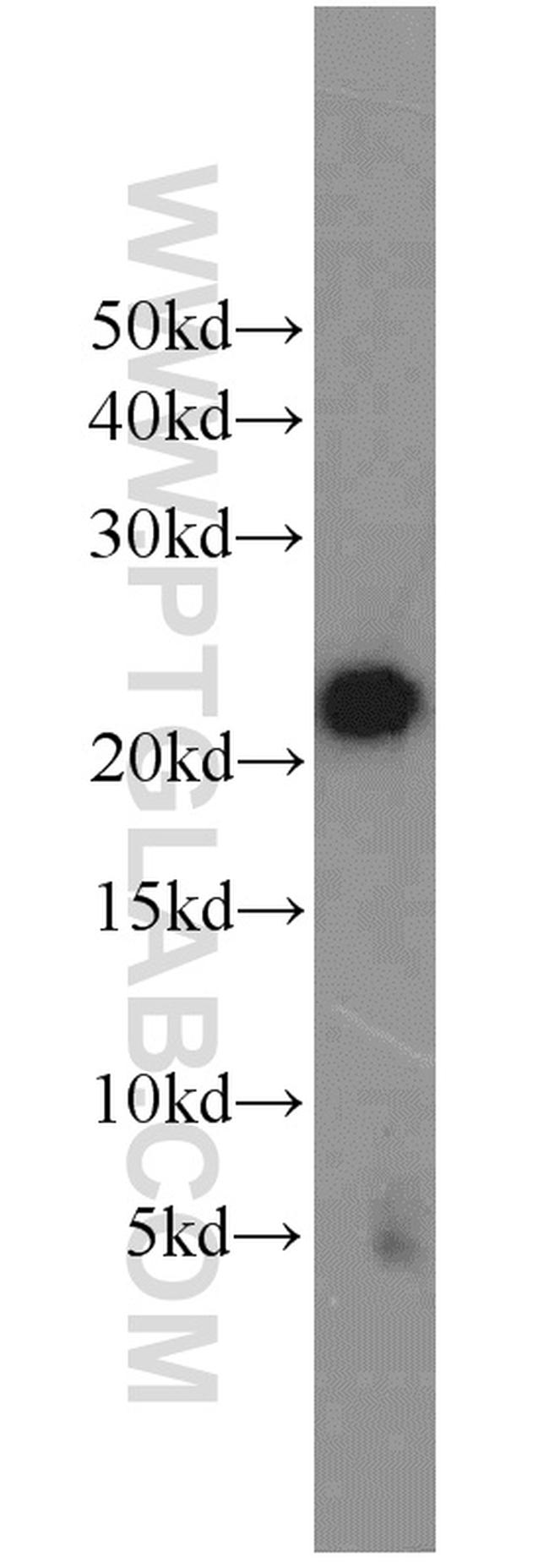 ITPA Antibody in Western Blot (WB)