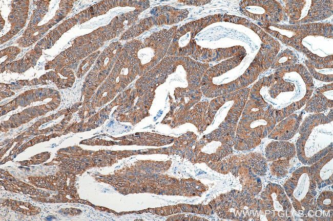 LAD1 Antibody in Immunohistochemistry (Paraffin) (IHC (P))