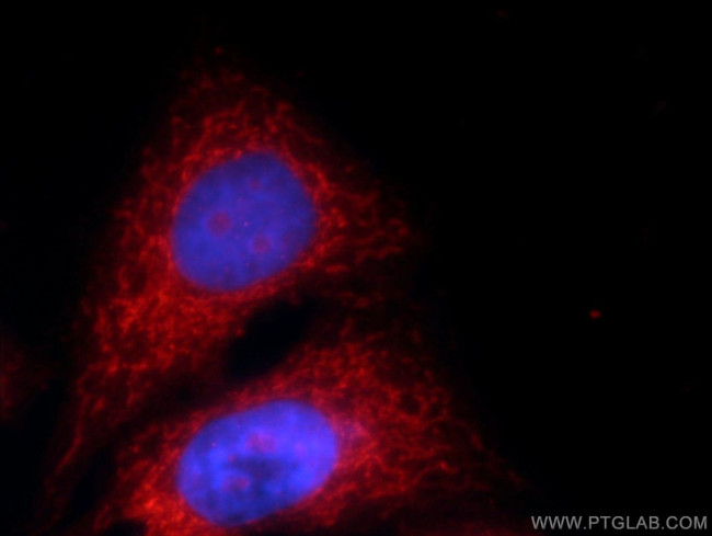 MRPS18B Antibody in Immunocytochemistry (ICC/IF)