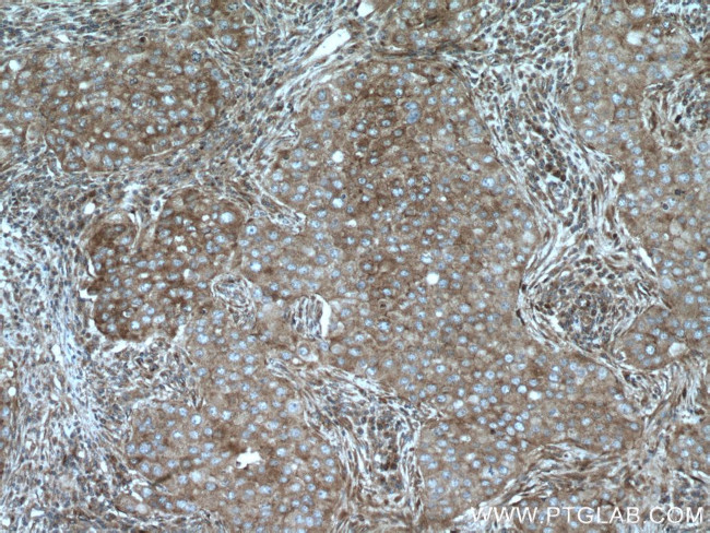 MRPS18B Antibody in Immunohistochemistry (Paraffin) (IHC (P))