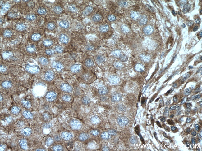 MRPS18B Antibody in Immunohistochemistry (Paraffin) (IHC (P))