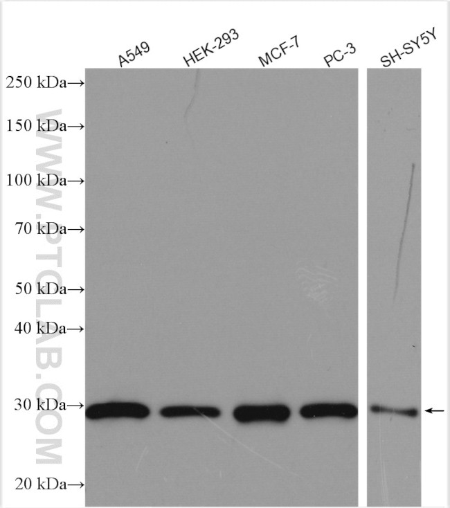 MRPS18B Antibody in Western Blot (WB)