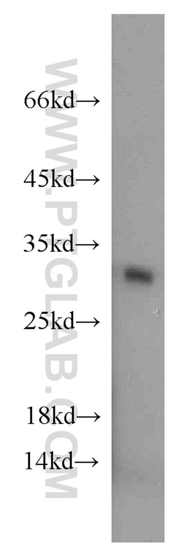 MRPS18B Antibody in Western Blot (WB)