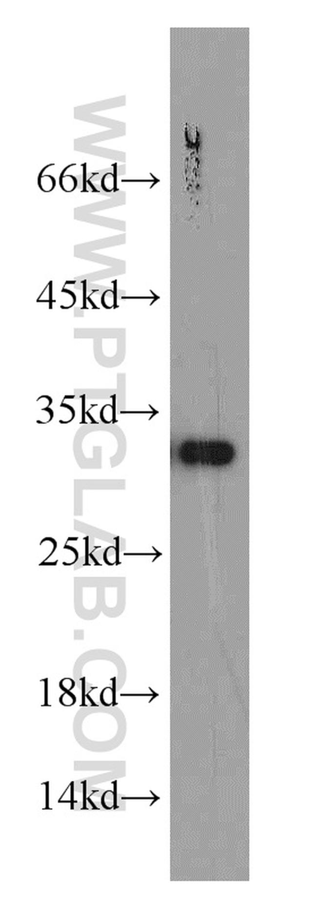 MRPS18B Antibody in Western Blot (WB)