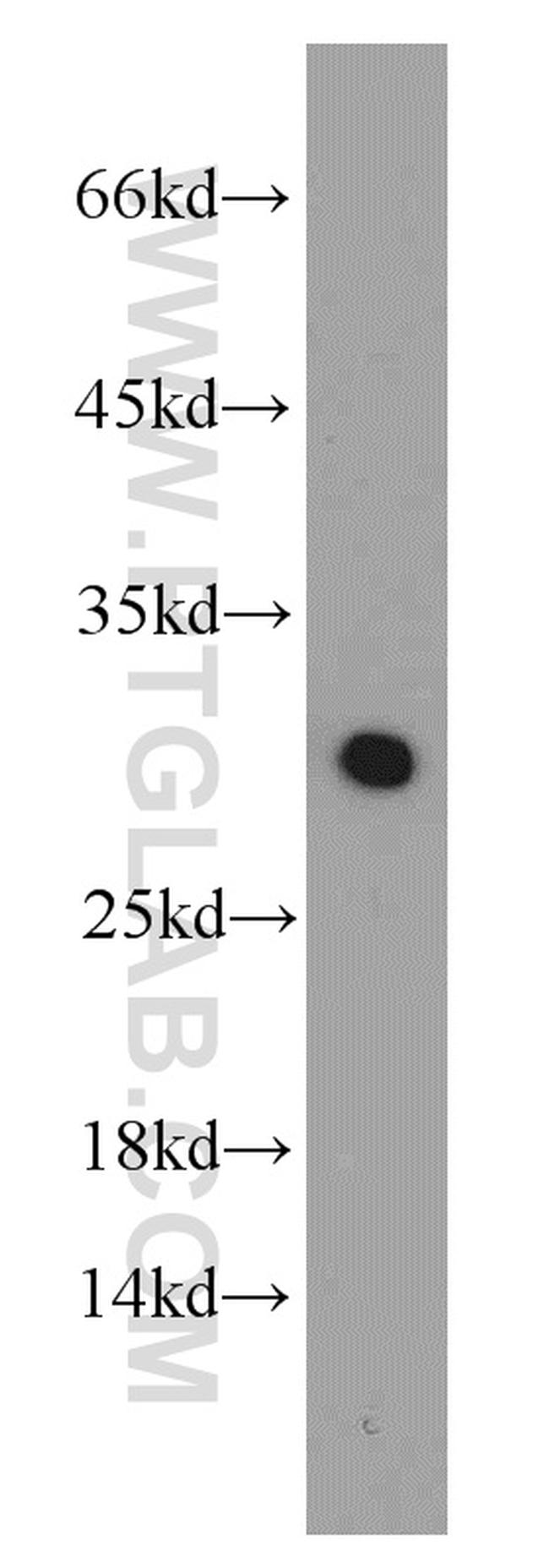 MRPS18B Antibody in Western Blot (WB)