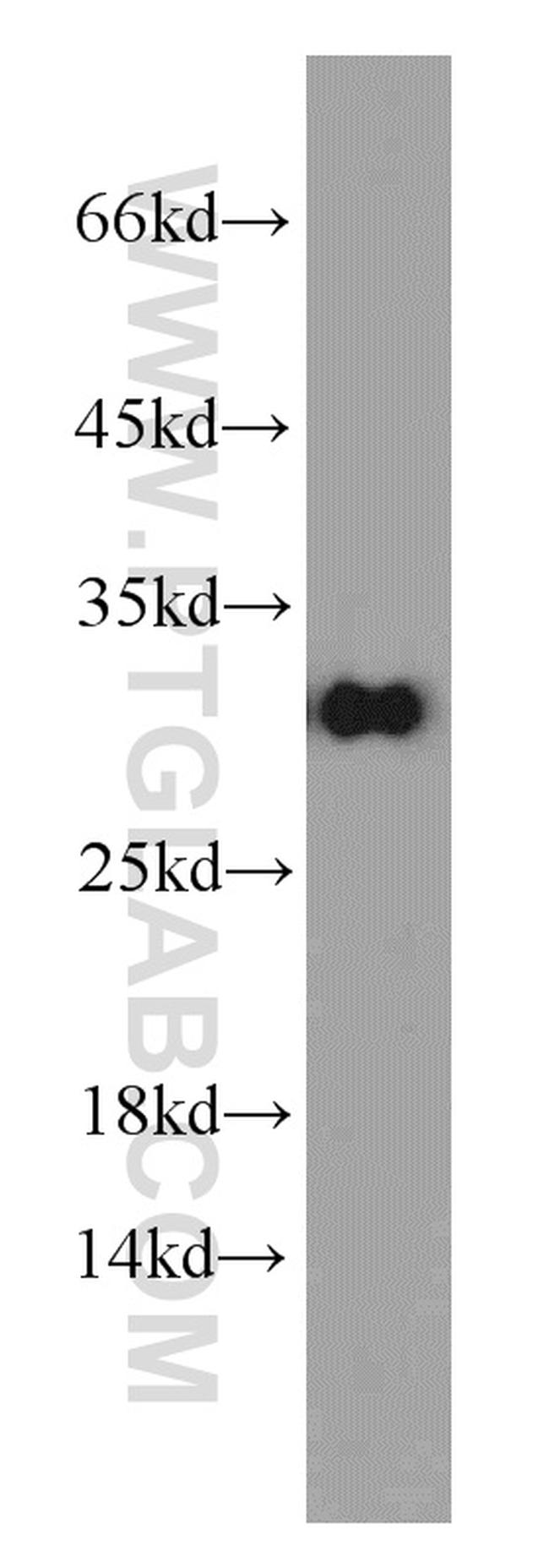 MRPS18B Antibody in Western Blot (WB)