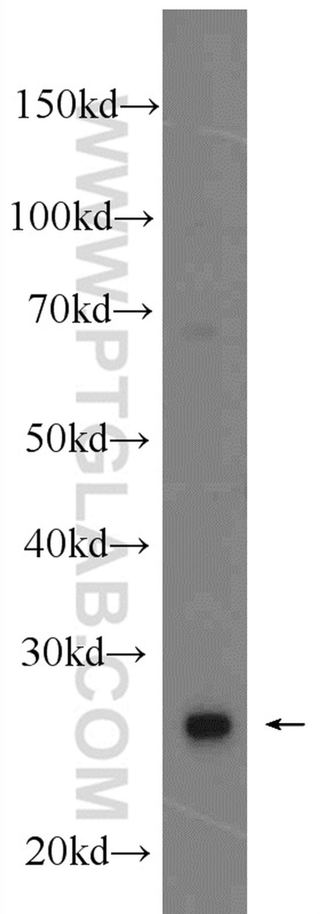 MRPS18B Antibody in Western Blot (WB)