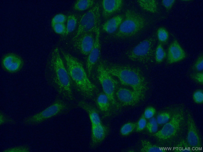 ACSF2 Antibody in Immunocytochemistry (ICC/IF)