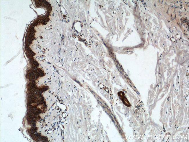 ACSF2 Antibody in Immunohistochemistry (Paraffin) (IHC (P))